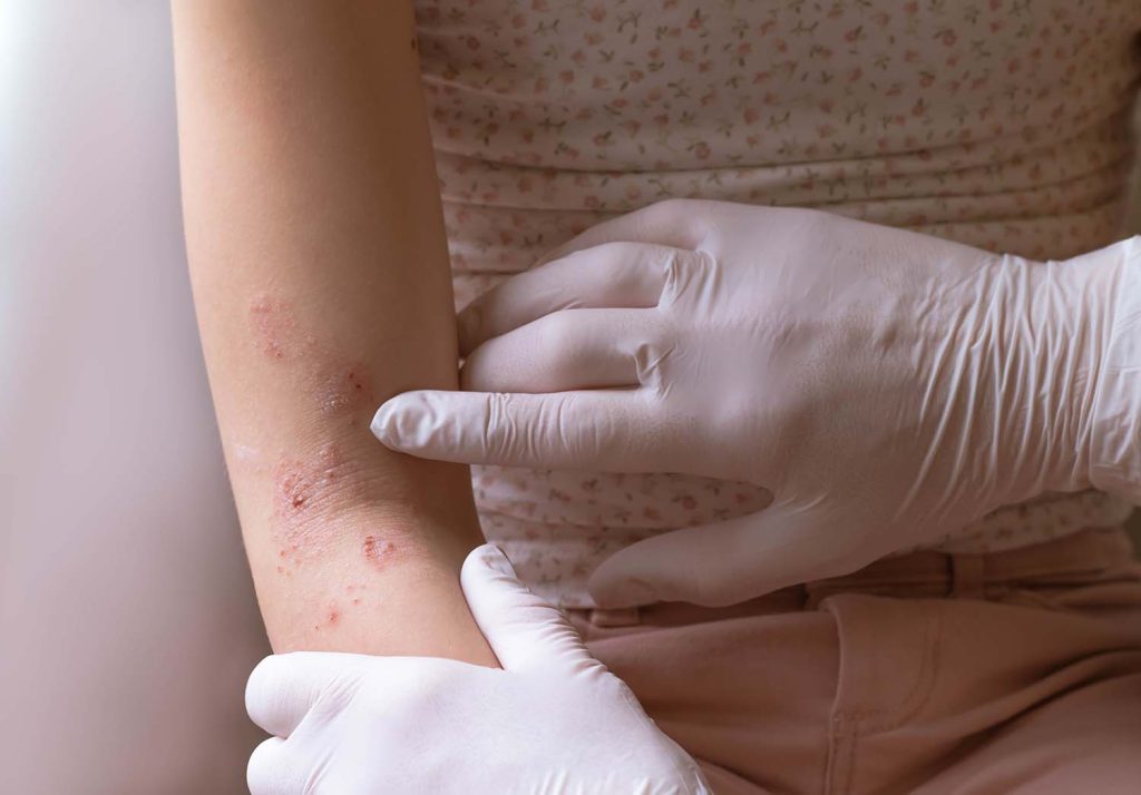 4 dr ayesha moolla not so glamourous side of dermatology