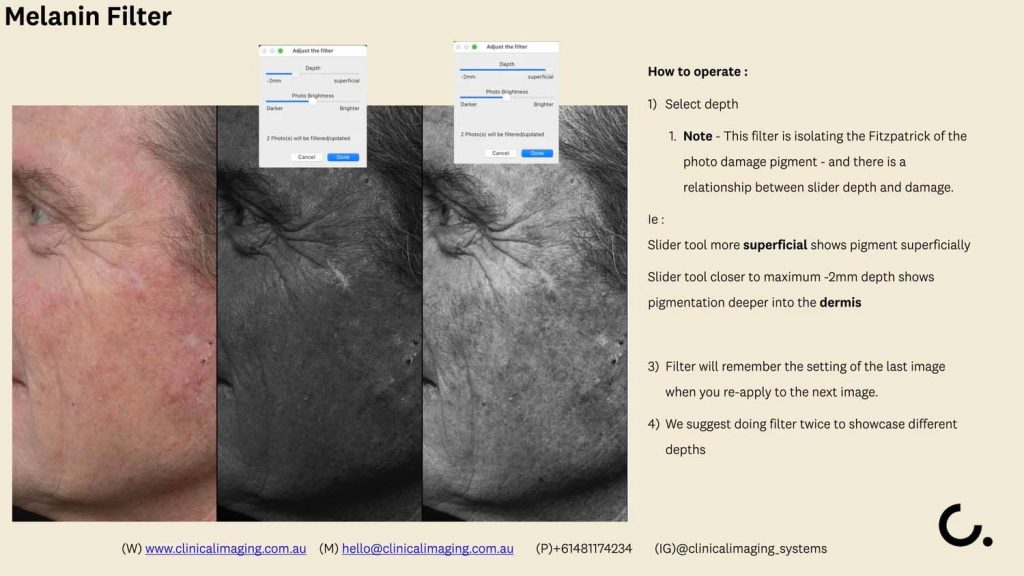 11 aesthetics non invasive clinical imaging australia aug 2025