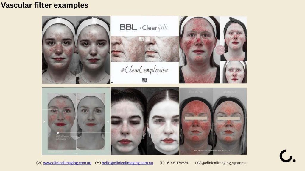 12 aesthetics non invasive clinical imaging australia aug 2025