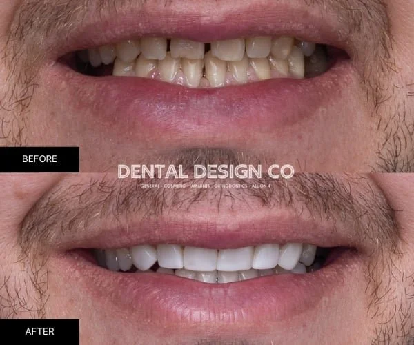 4 dentistry clinical imaging australia aug 2025