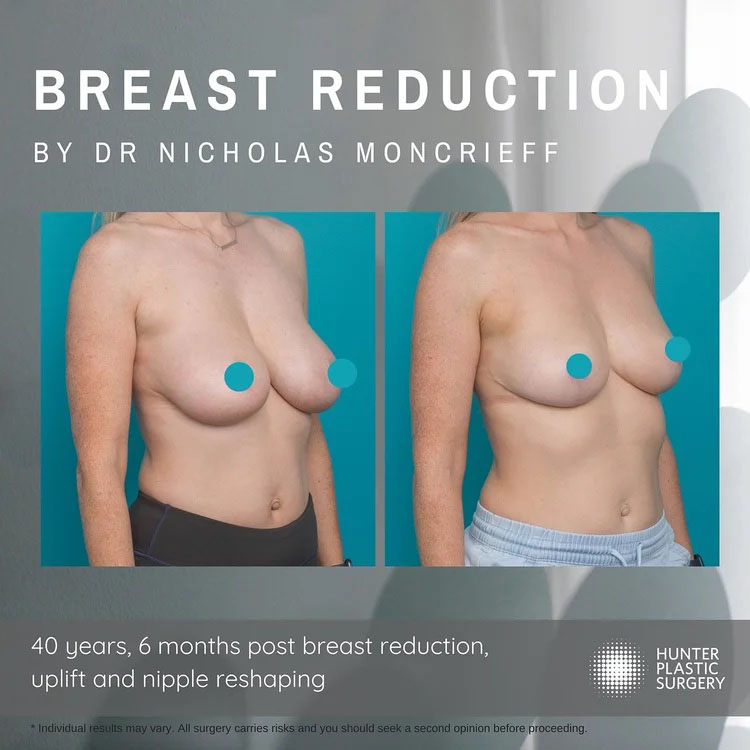 5 plastic surgery clinical imaging australia aug 2025