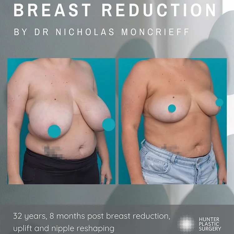 7 plastic surgery clinical imaging australia aug 2025 edited