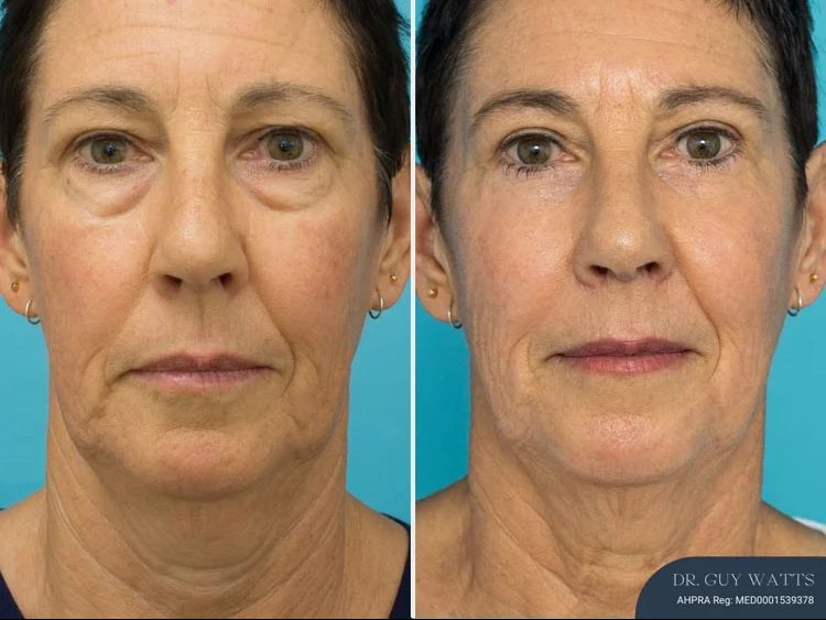 8 plastic surgery clinical imaging australia aug 2025 edited 1