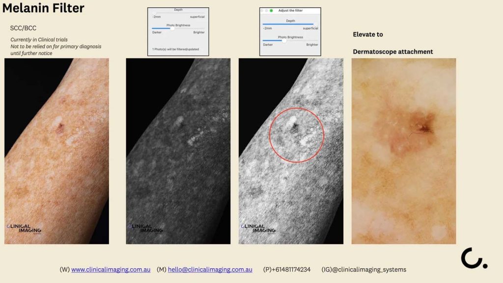 9 aesthetics non invasive clinical imaging australia aug 2025