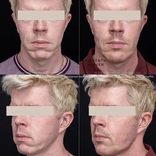 9 plastic surgery clinical imaging australia aug 2025 edited