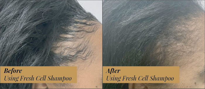 2 fresh cell dr bhamjee jan 2026