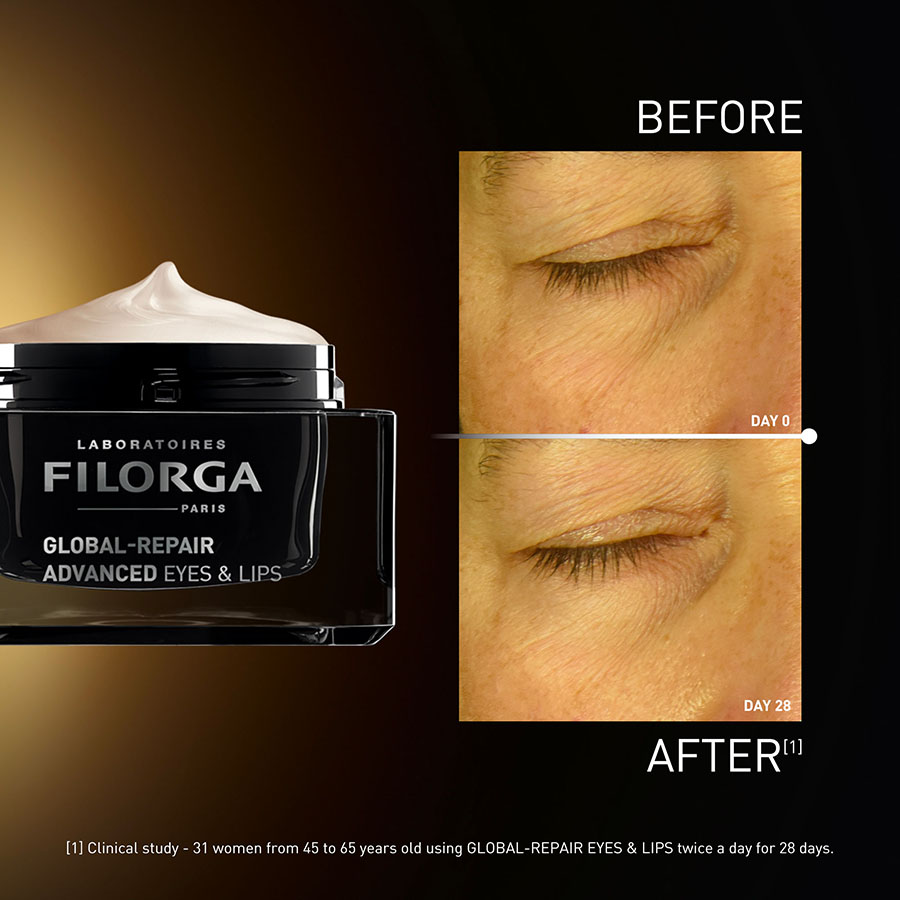 3 Filorga Launches GLOBAL REPAIR ADVANCED EYES LIPS feb 2026