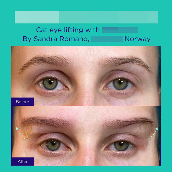 9 GA active mint lift pdo threads mar 2026