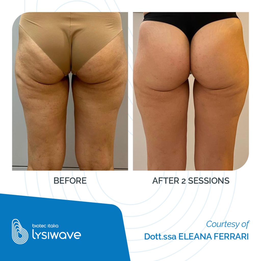 7 medi aesthetic solutions LYSIWAVE may 2026