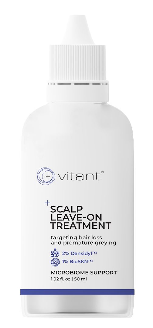 2 vitant hairloss solutions jul 2026 scalp treatment bottle e1785418441432