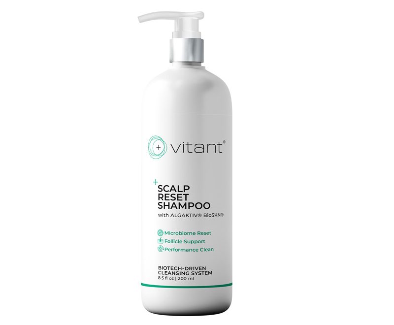 3 vitant hairloss solutions jul 2026 shampoo e1785418530750