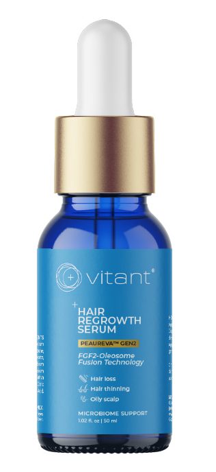 4 vitant hairloss solutions jul 2026 Hair Regrowth Serum e1785417952564