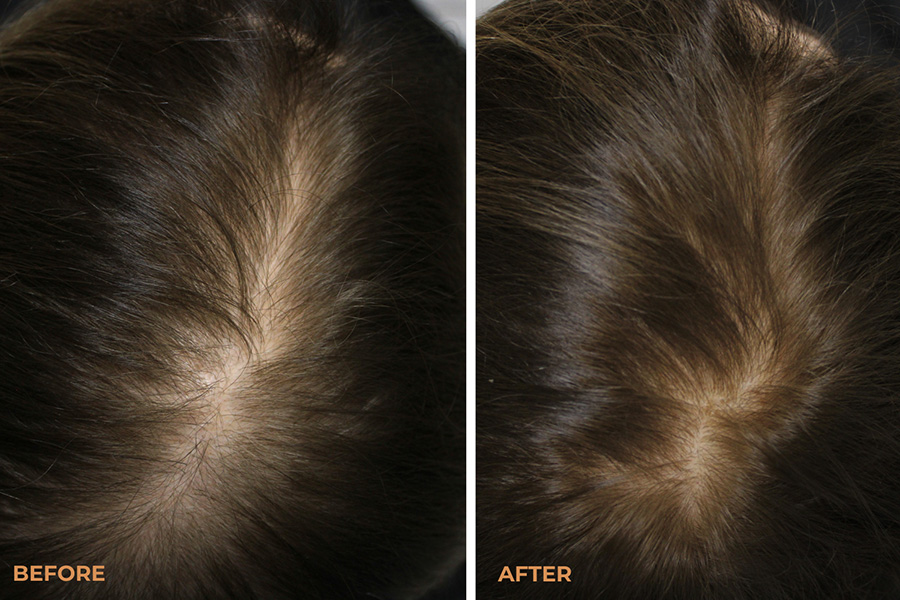 8 vitant hairloss solutions jul 2026