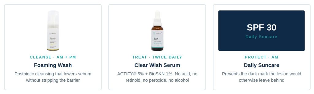 4 vitant skincare acne aug 2026