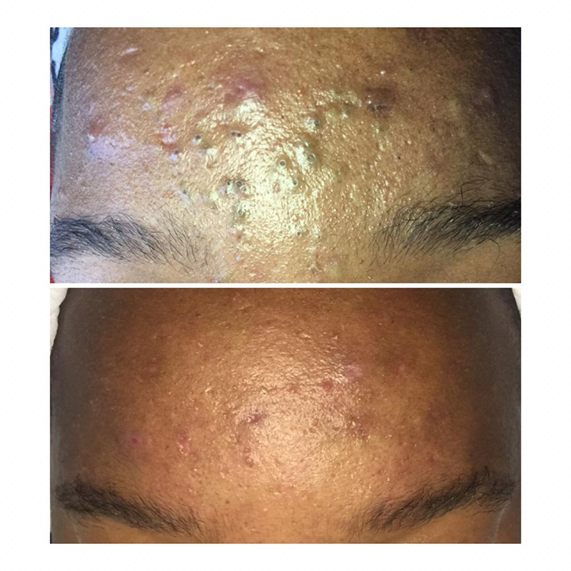 10 Pulse GFIT aq skin solutions regenerative treatments aug 2026
