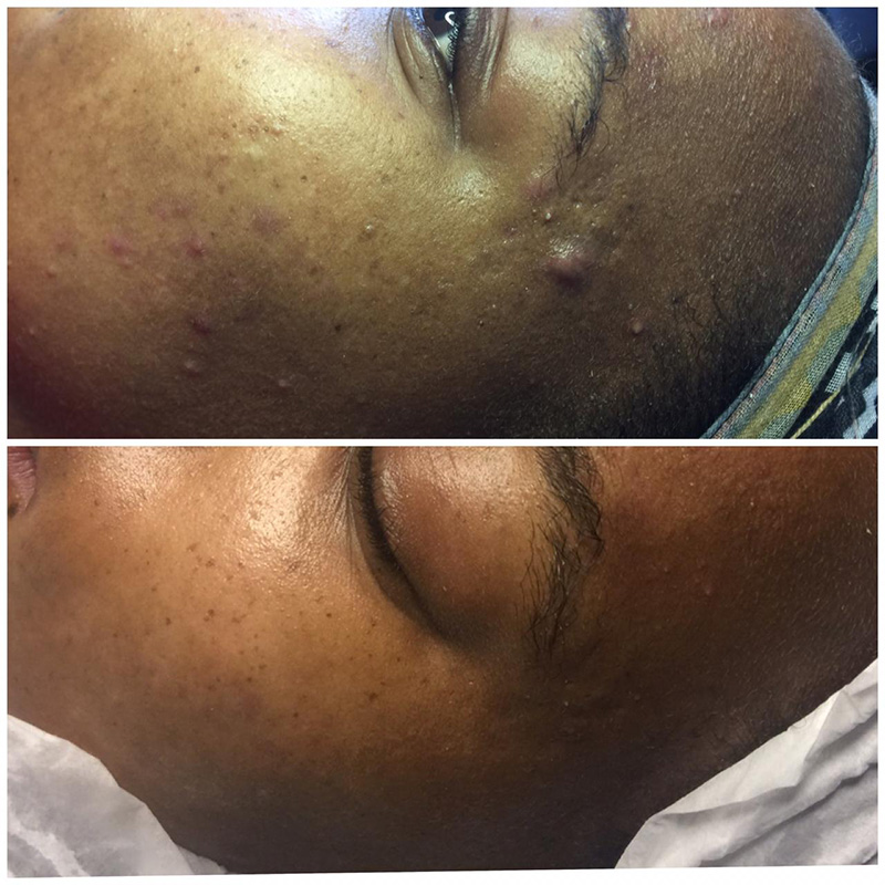 11 Pulse GFIT aq skin solutions regenerative treatments aug 2026