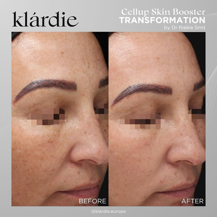 11 klardie R and D sep 2026