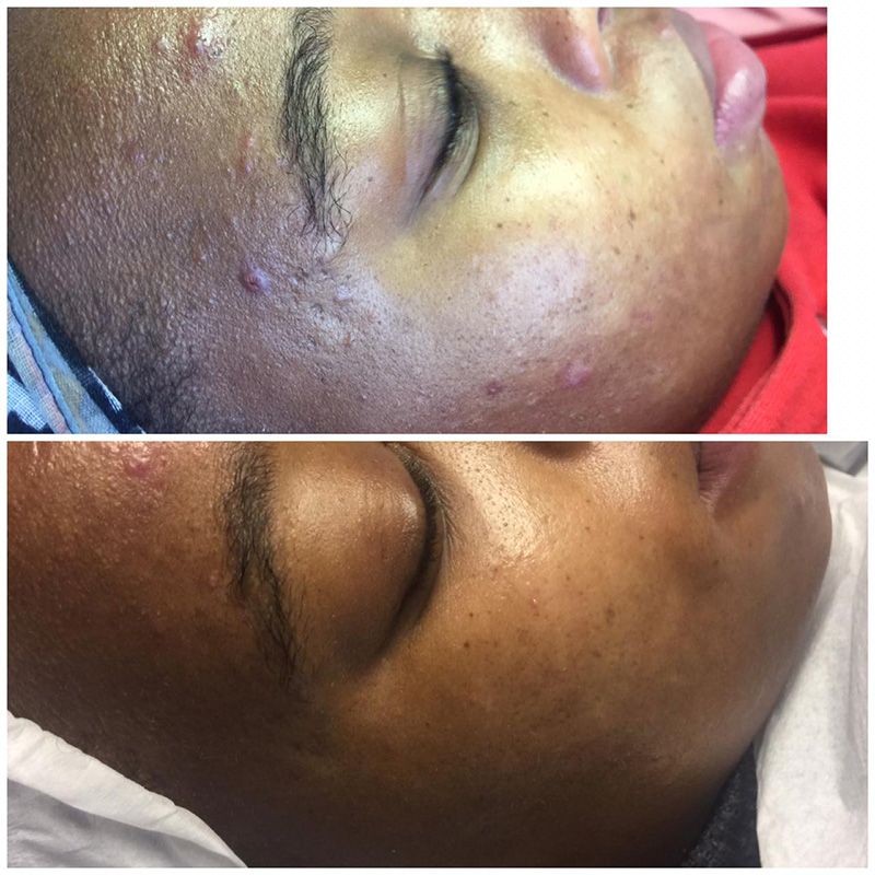 12 Pulse GFIT aq skin solutions regenerative treatments aug 2026