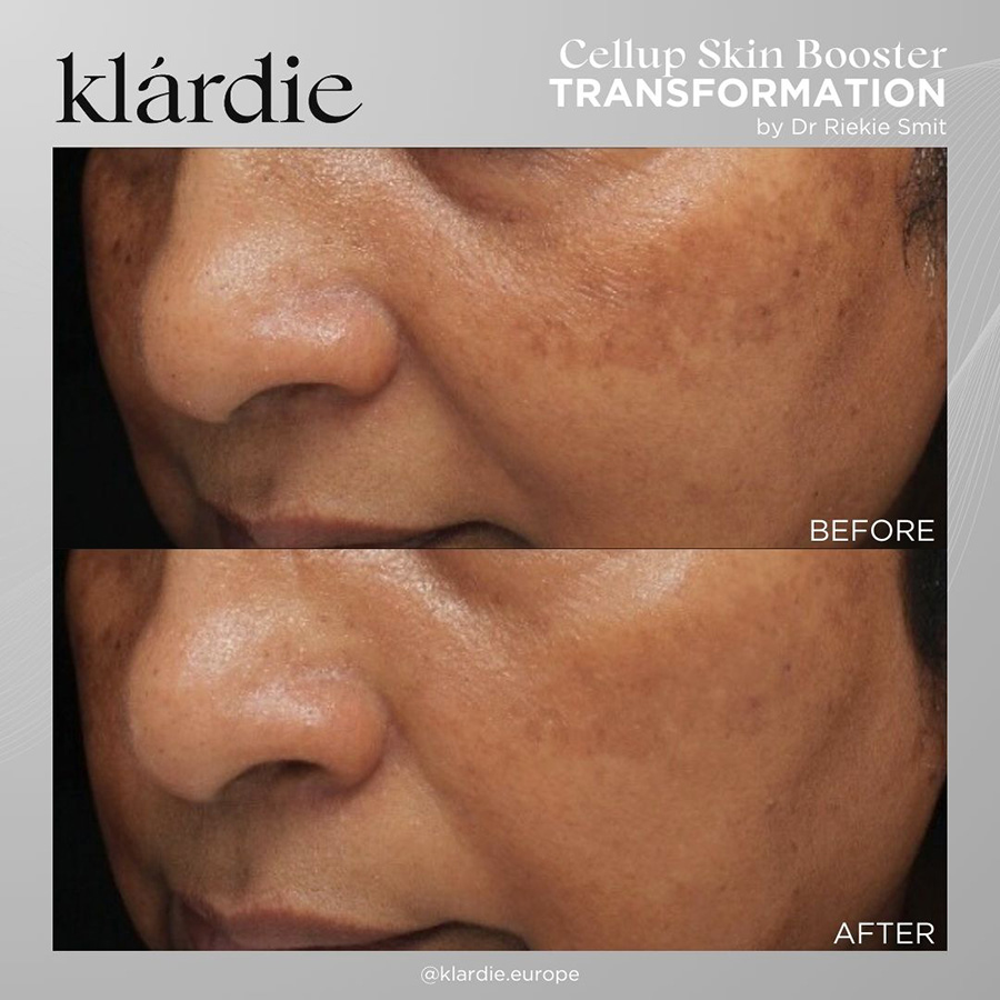 12 klardie R and D sep 2026