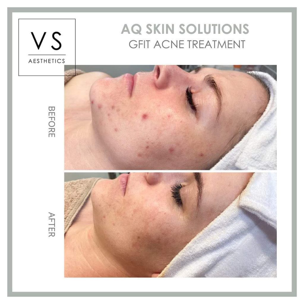 13 Village Skin GFIT aq skin solutions regenerative treatments aug 2026