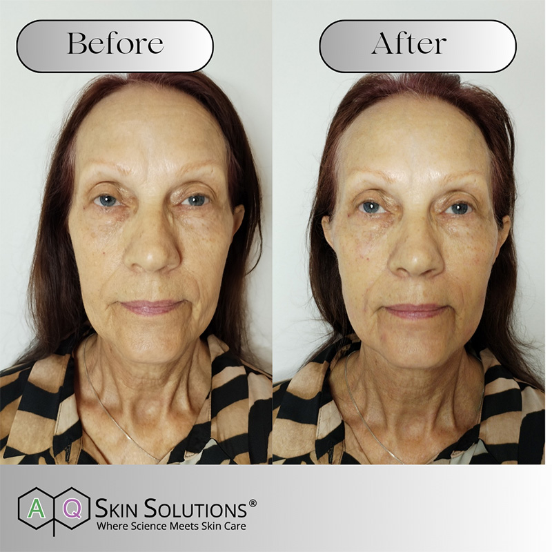 19 Retouch crop forehead to top lip aq skin solutions regenerative treatments aug 2026