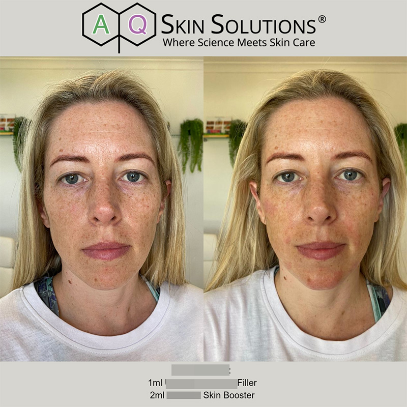20 Retouch ultradeep Kirst aq skin solutions regenerative treatments aug 2026