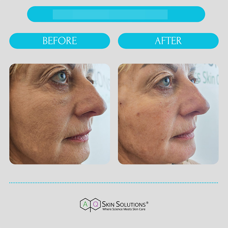 21 Retouch aq skin solutions regenerative treatments aug 2026