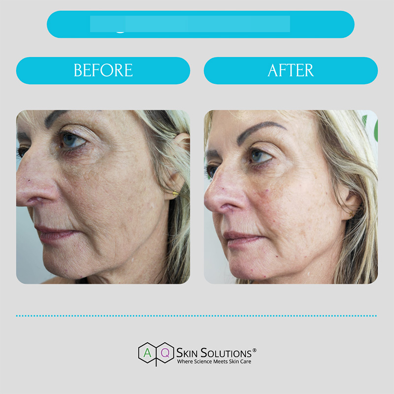 22 Retouch aq skin solutions regenerative treatments aug 2026