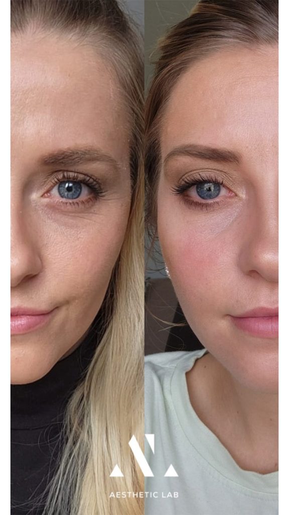 23 Aesthetic Lab Retouch aq skin solutions regenerative treatments aug 2026