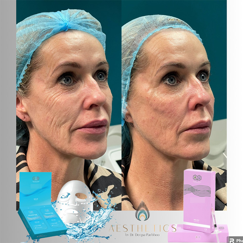 24 Dr DeepaRetouch Ultra Deep aq skin solutions regenerative treatments aug 2026