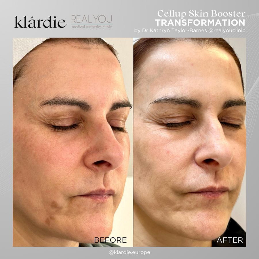 6 klardie R and D sep 2026