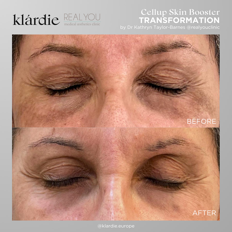 7 klardie R and D sep 2026