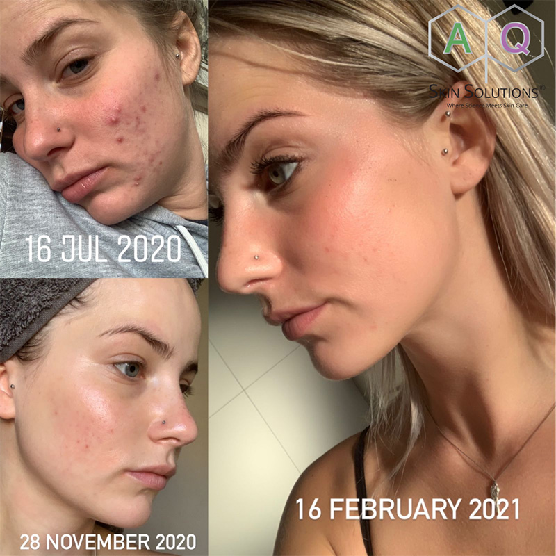 8 GFIT aq skin solutions regenerative treatments aug 2026