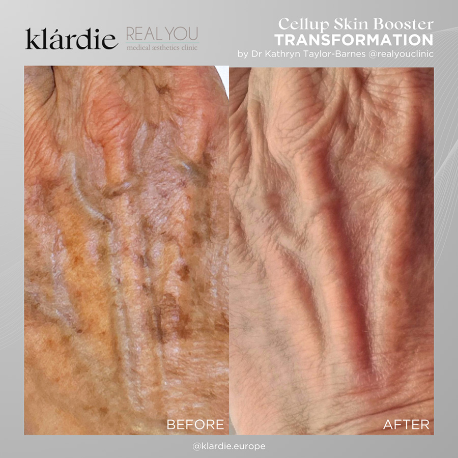 8 klardie R and D sep 2026 Dr Kathryn hands