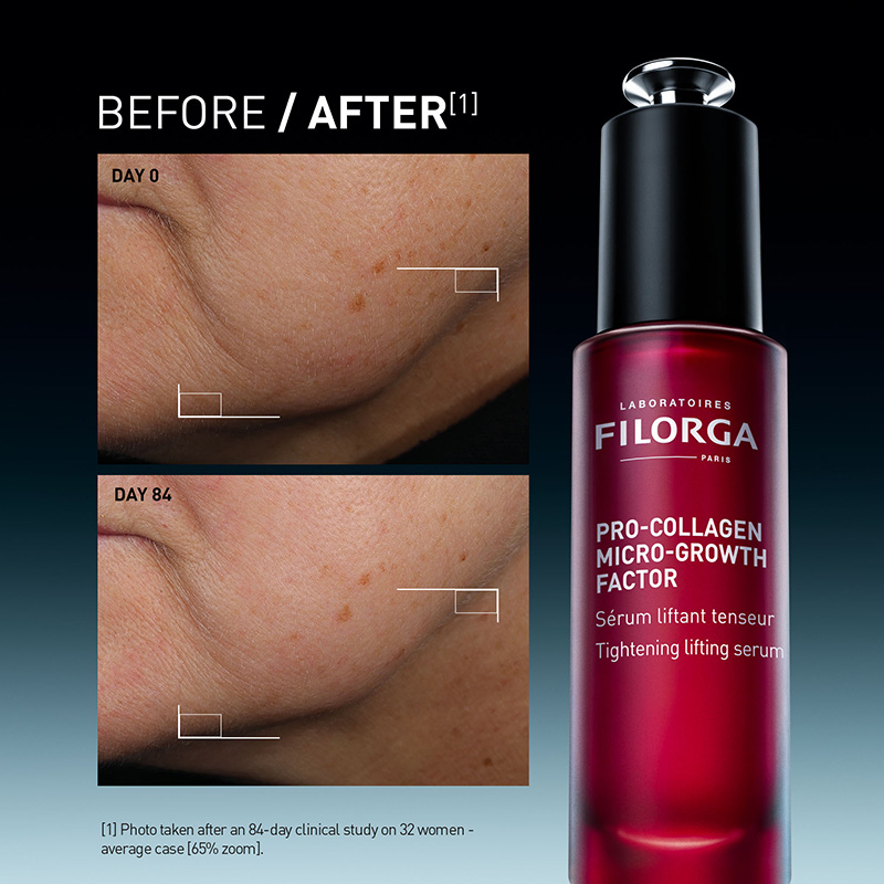 5 tightening lifting serum filorga pro collagen growth factor launch oct 2026