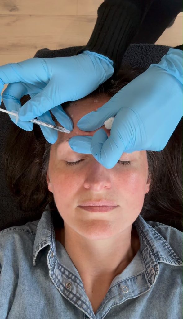 6 kelli clifton botox dr michelle hutton