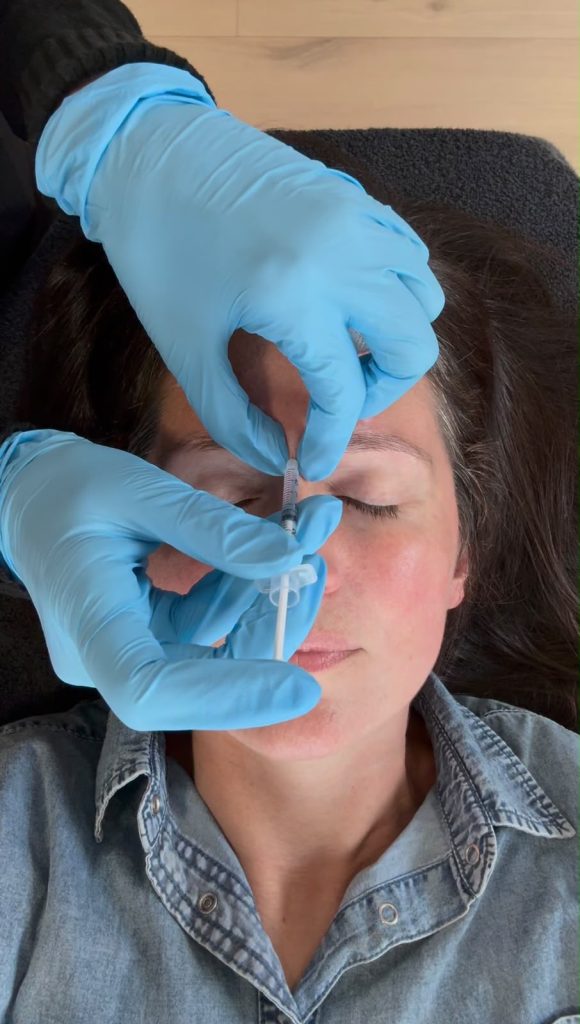 7 kelli clifton botox dr michelle hutton