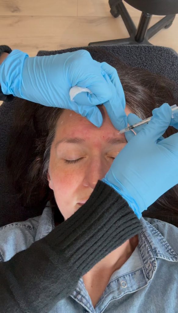 8 kelli clifton botox dr michelle hutton
