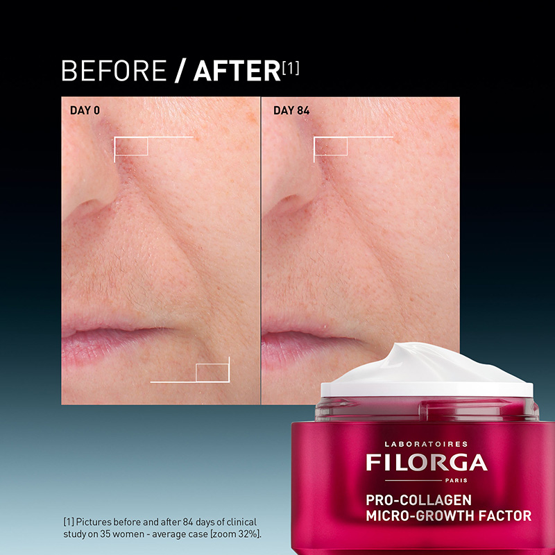 9 cream filorga pro collagen growth factor launch oct 2026